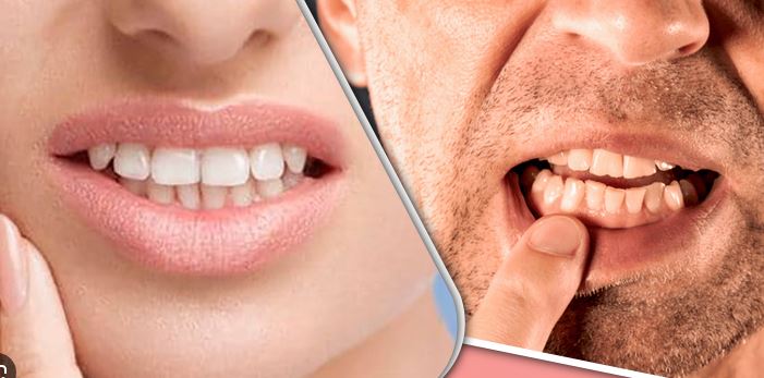 ডায়াবেটিক রোগীর দাঁত ও মাড়ির যত্ন