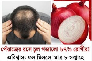 পেঁয়াজের রসে চুল গজানো…২০২৫